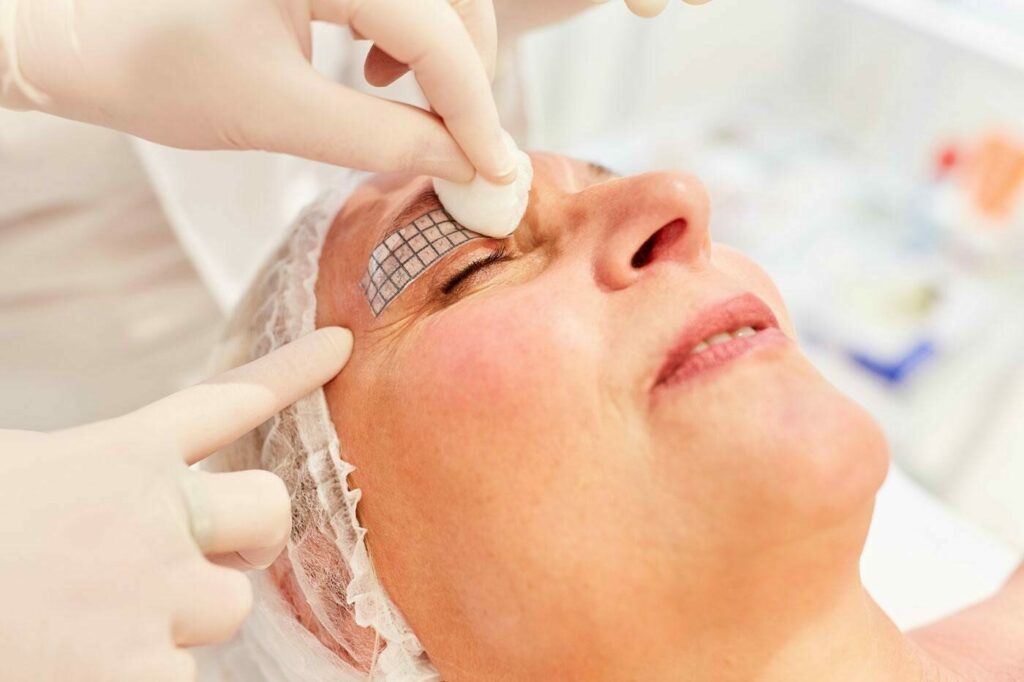 Thermage FLX รอบดวงตา