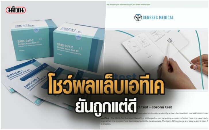 SSAD
