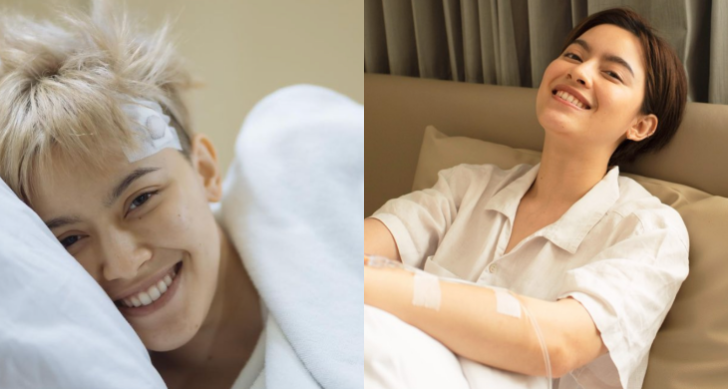 nnv4