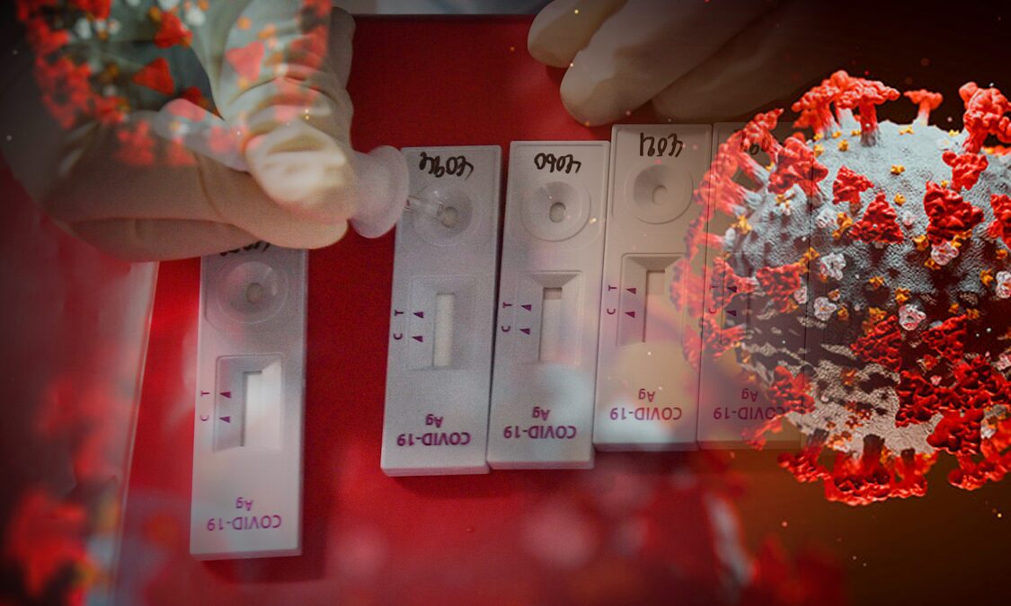 ‘อธิบดี’แนะวิธีใช้-คุณสมบัติ ชุดตรวจโควิด Antigen Test Kit
