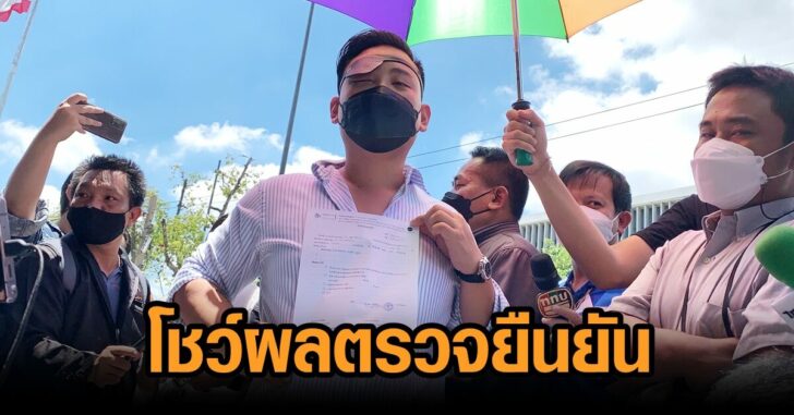 ลูกนัท-ตาบอดจริง