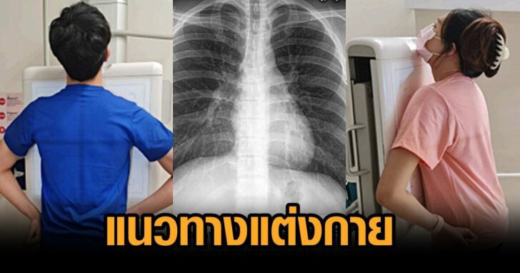 แต่งกาย-เอกซเรย์ปอด