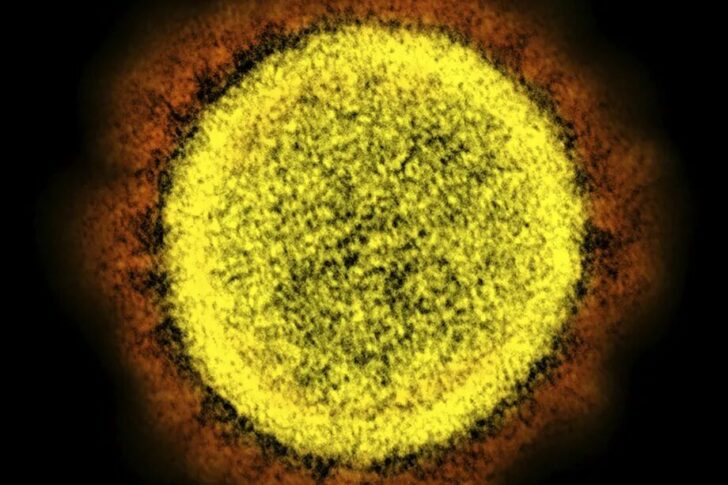 NIAID-NIH via Associated Press