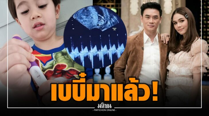 ณณ000002