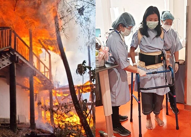 หมอโอ๋-หลังผ่าตัด