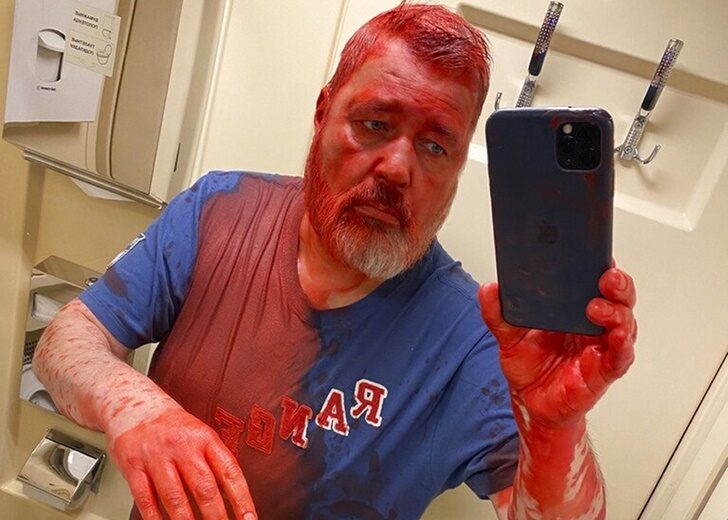 Russia Editor Attacked