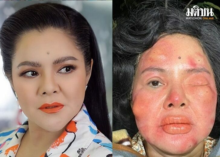 ฮาย อาภาพร
