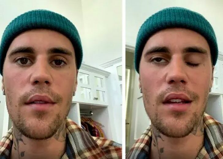 justin-beiber-face-palaris