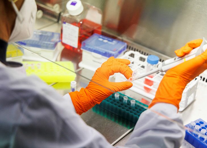 monkeypox-lab-test