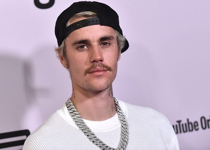 Justin Bieber says suffering from facial paralysis