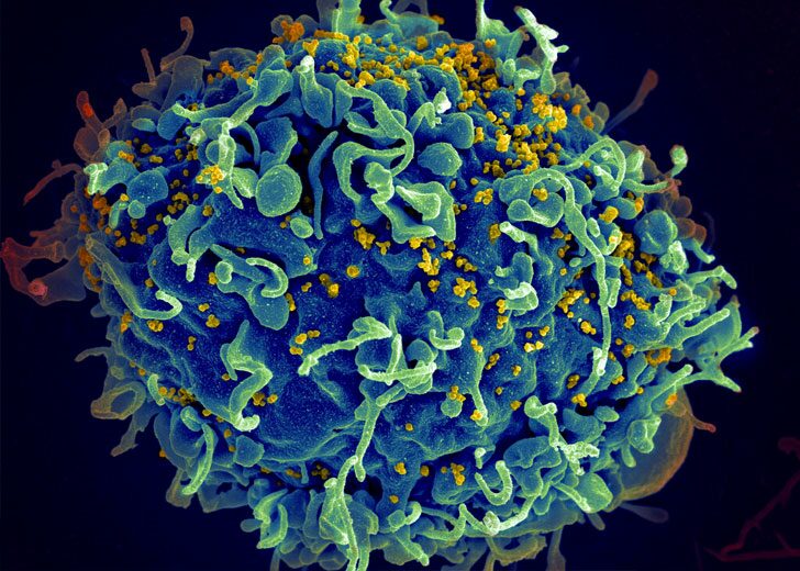 virus-hiv-aids
