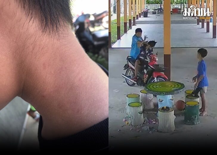 เตะ4