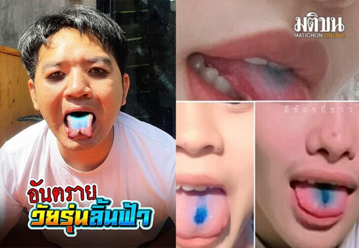 วัยรุ่นลิ้นฟ้า12548