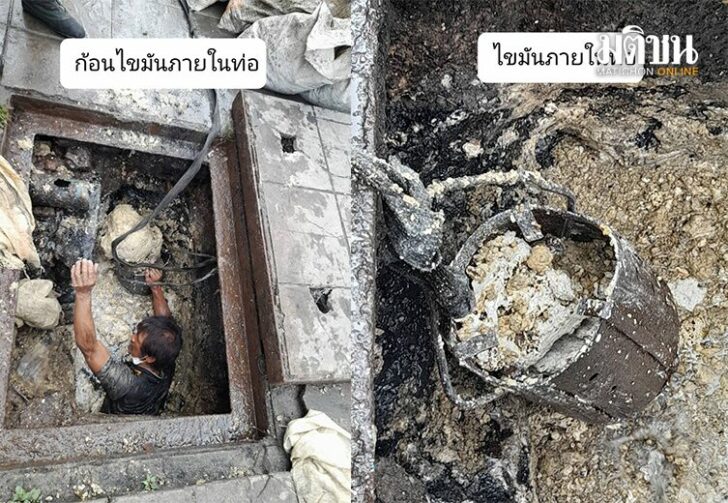 ก้อนไขมันในท่อ