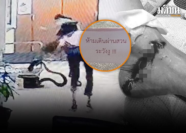 งูกัด 728