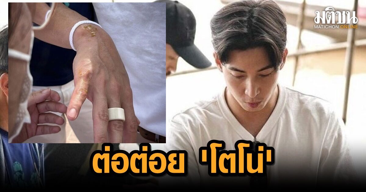 ‘โตโน่’ โดนต่อต่อยที่ลาว ผู้จัดการเผยปลอดภัยดี เชื่อสิ่งศักดิ์สิทธิ์มาทักทาย