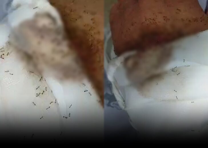 มดขึ้น 45