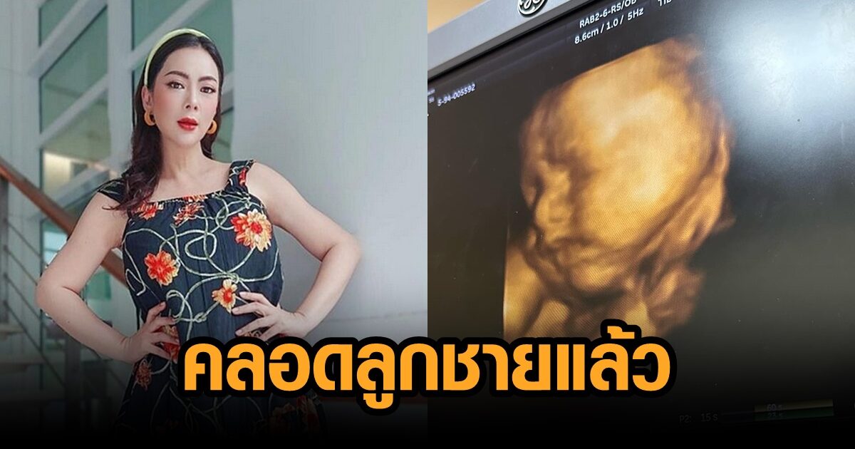 บุ๋ม ปนัดดา คลอดลูกชายแล้ว ถือฤกษ์ดี 11.11 น. น้ำหนักตัว 2,920 กรัม