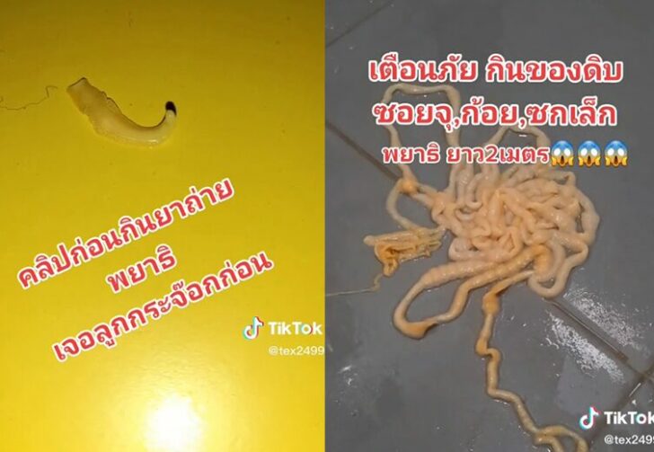 ขนาดเว็บพยาธิซอยจุ๊