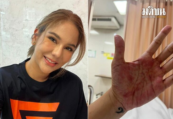 ขนาดเว็บแพ้ยารุนแรง
