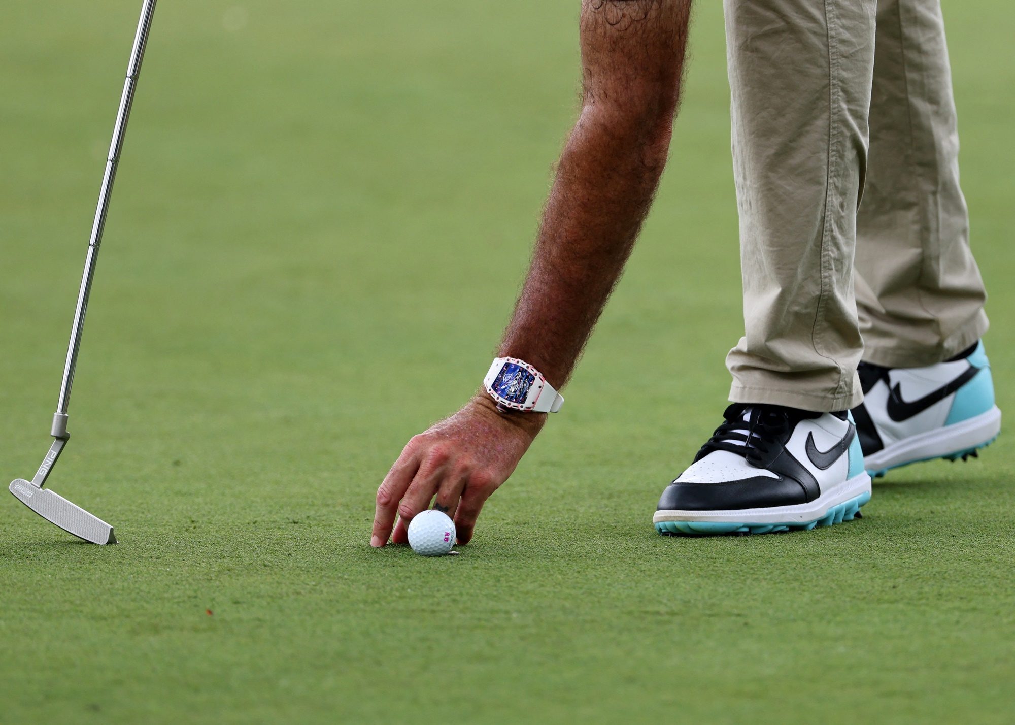  Golf Injury Alert How A 16 Year Old Boy Sustained A Hernia While 