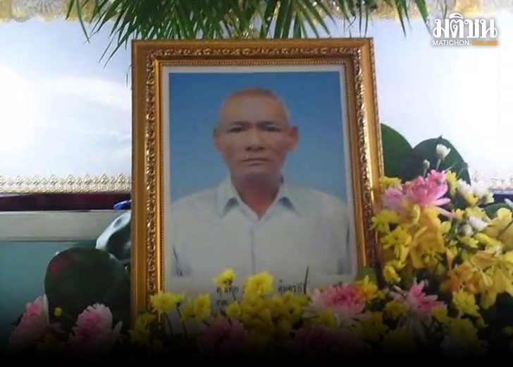 ลูกสาวคาใจ ลุงถอนฟัน7288