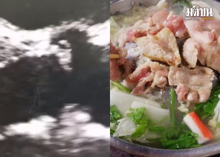 หมู เว็บ