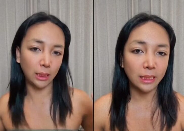 กะทิ ผ่าไส้ติ่ง
