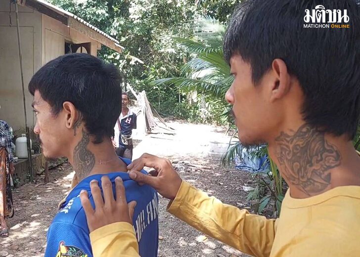 บาดคอ5745
