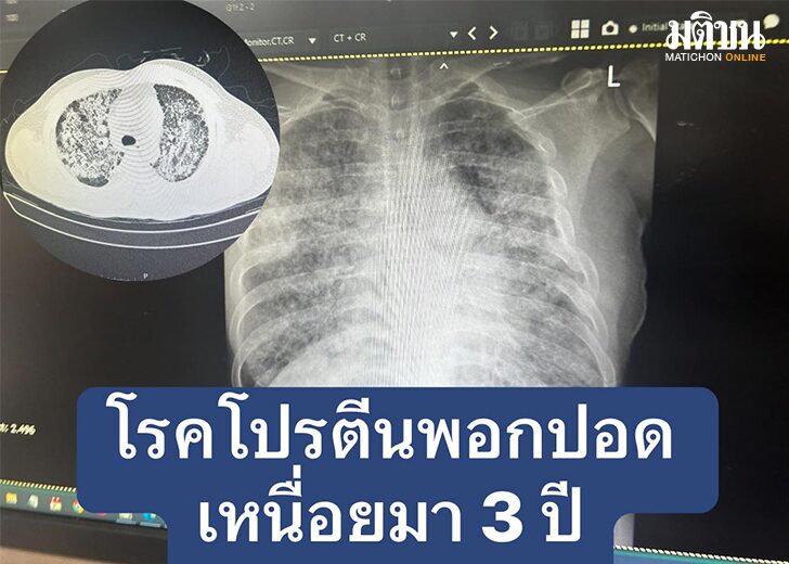 เหนื่อยมา3ปี484