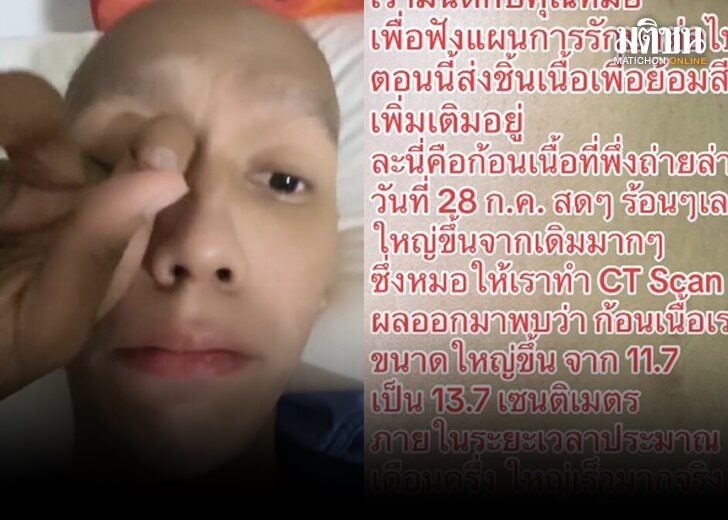 ภป มะเร็ง 413