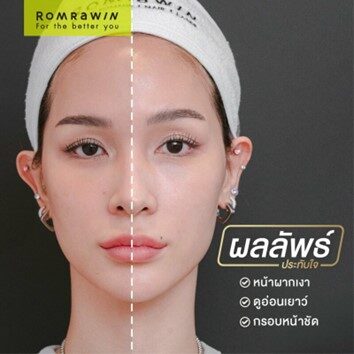 botoxริ้วรอย botoxริ้วรอย