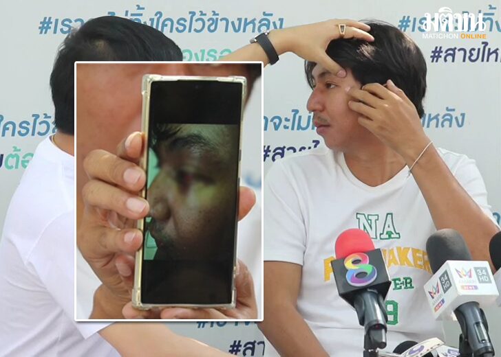 โดนต่อย