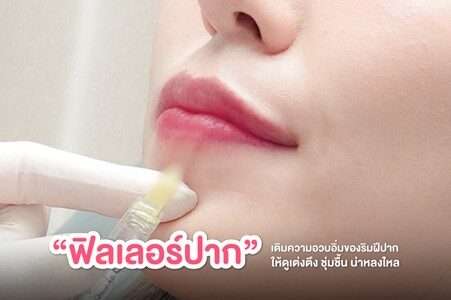01 ฟิลเลอร์ปาก