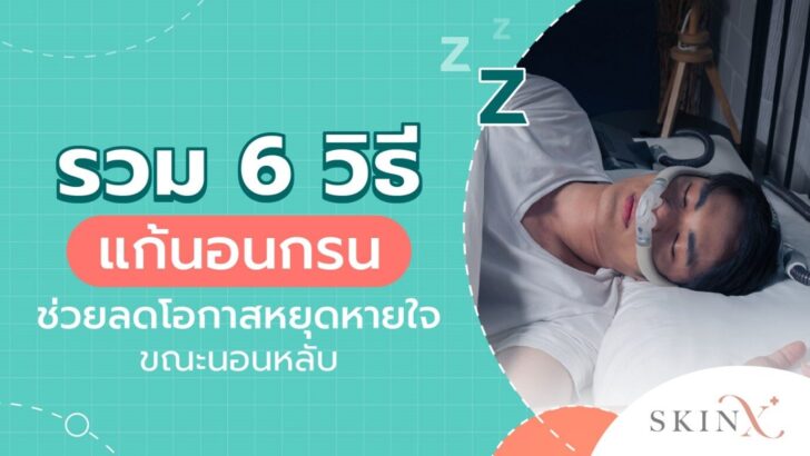 แก้นอนกรน