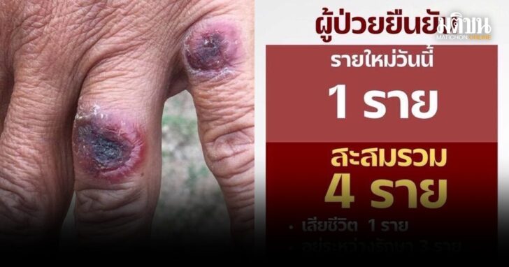 มุกดาหาร-แอนแทรกซ์เพิ่ม1