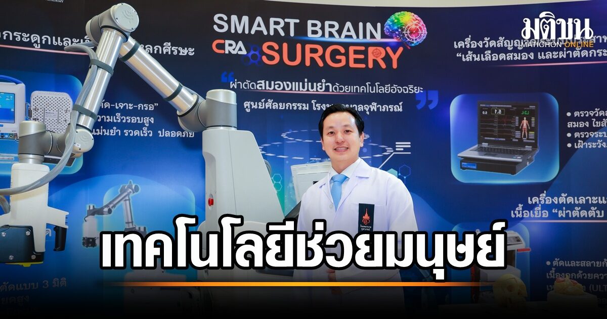 หุ่นยนต์ช่วยผ่าตัดสมอง: เทคโนโลยีแห่งอนาคตที่พลิกโฉมวงการแพทย์ไทย
