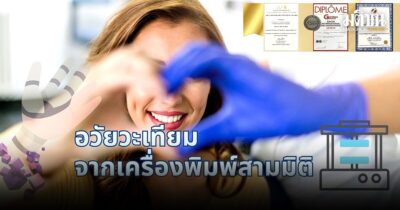 อวัยวะเทียม จากเครื่องพิมพ์ 3 มิติ