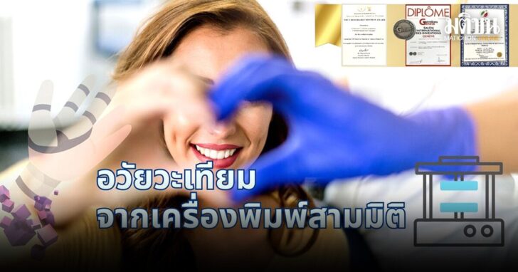 life อวัยวะเทียม จากเครื่องพิมพ์ 3 มิติ