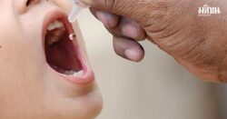 ลาว พบ ‘เชื้อไวรัสโปลิโอ’ ชนิดวัคซีนกลายพันธุ์ ระบาด หลังเจอป่วย กล้ามเนื้ออัมพาตเฉียบพลัน