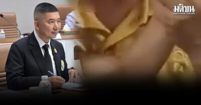 แพทยสภา อัพเดตอาการเด็ก 3 ขวบ ถูกหมอราดน้ำร้อน เล็งเพิ่มนโยบายรักษาบุตรแรงงานต่างชาติ