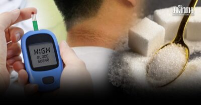 แพทย์ตอบชัด! หลังคอดำ-มดตอมฉี่ ป่วยเบาหวานจริงไหม? เปิดอาการเริ่มต้น ย้ำกินยาไม่ทำไตพัง