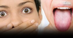 หมอสุรัตน์ เผยอย่ามองข้าม กลิ่นปาก-เลือดออกตอนแปรงฟัน สัญญาณเตือนเสี่ยงเป็น ‘อัมพาต’