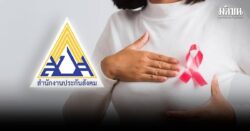 ประกันสังคม ให้สิทธิผู้ประกันตน ม.33-ม.39 ตรวจเต้านม ฟรี เช็กเงื่อนไข-ขั้นตอน