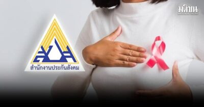 ประกันสังคม ให้สิทธิผู้ประกันตน ม.33-ม.39 ตรวจเต้านม ฟรี เช็กเงื่อนไข-ขั้นตอน