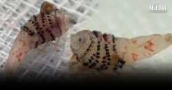 เพจดังเฉลยแล้ว! ตัวอะไร อยู่ใต้ผิวหนังคนไข้ต่างชาติกลับจากบราซิล แนะ ถ้าเจอให้รีบไปหาหมอ