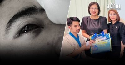 ประกันสังคม เร่งประสานรพ.แจง ผู้ประกันตนผ่าตัดริดสีดวงจมูกทำตาบอด เพื่อพิจารณาเยียวยา