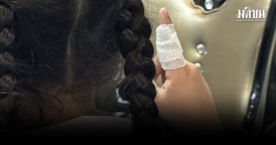 แม่พาลูกป.5 แจ้งความ หลังถูกแม่เพื่อนตบหน้า-หักนิ้ว ฉุนถูกแย่งที่นั่งเรียนพิเศษ