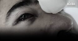 ญาติโวย รพ.เอกชนดัง ผ่าตัดริดสีดวงจมูก พลาดตาบอด จี้รับผิดชอบ