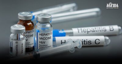 กรมควบคุมโรค ยัน ไทยยังคงให้วัคซีนไวรัสตับอักเสบบี ในทารกแรกเกิดทุกราย แม้สหรัฐยกเลิก